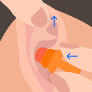 Finger ziehen Ohrmuschel hoch, setzen orange Ohrstöpsel tief in den Gehörgang ein